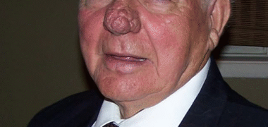 Aimé Roy