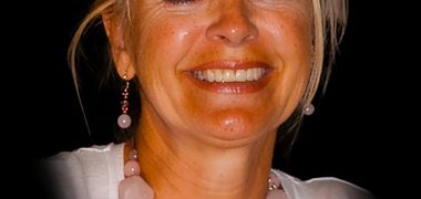 Francine Lévesque