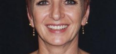 Louise Simoneau