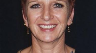 Louise Simoneau